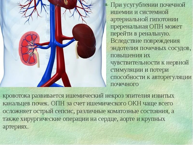 Гипотония почек. Патология сосудов почек. Почки и артериальная гипотония.