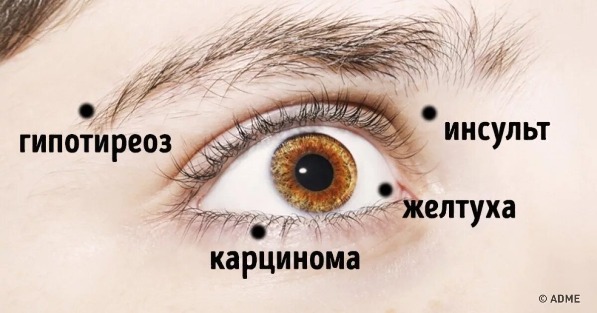 Определение глазки. Определение болезней по глазам. Болезни по глазам человека. Болезни определяющие по глазам.