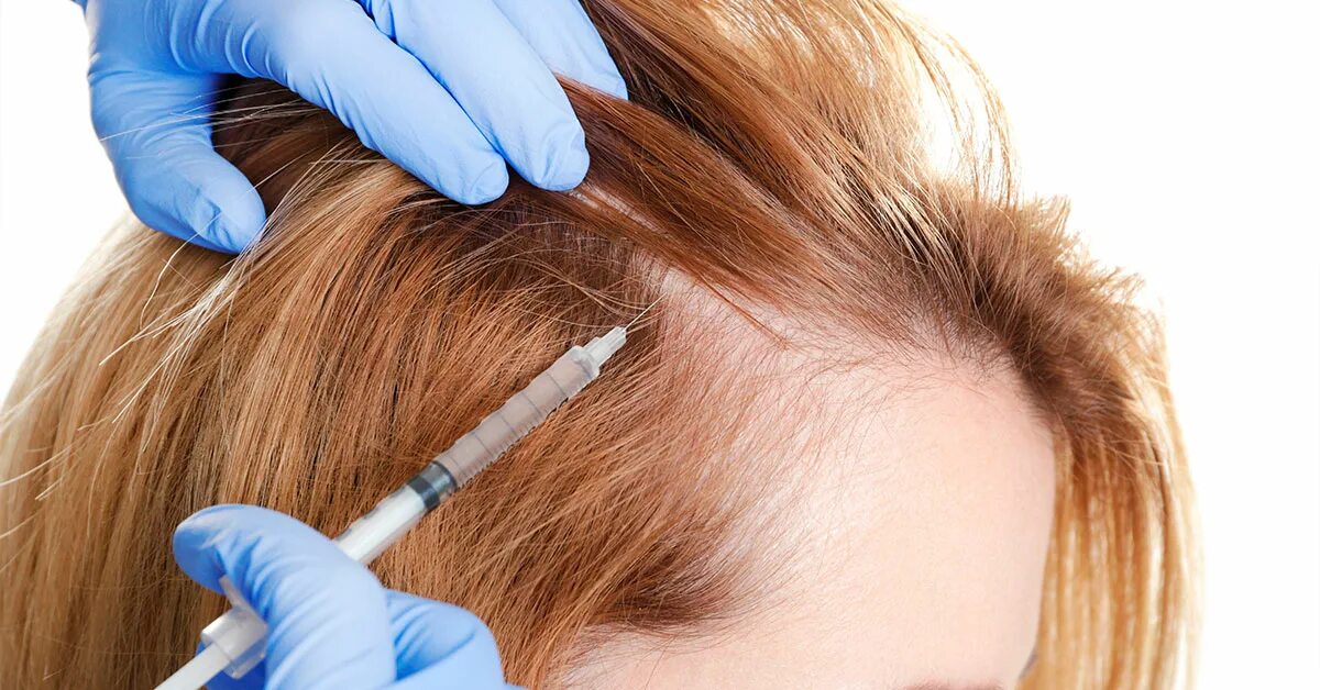 Какую процедуру сделать для волос. Hair treatment мезотерапия. Мезо волосистой части головы. PRP плазмотерапия для волос. Мезотерапия для волос.