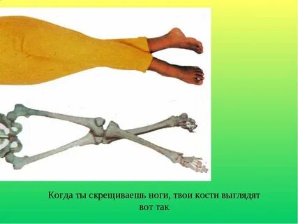 Твои кости
