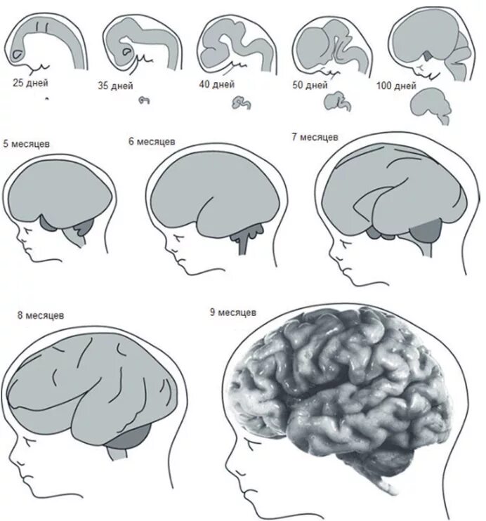 Внутриутробное недоразвитие головного мозга. Этапы развития коры головного мозга. Недоразвитие коры головного мозга. Схема развития головного мозга. Схема развития головного мозга человека фронтальный разрез.