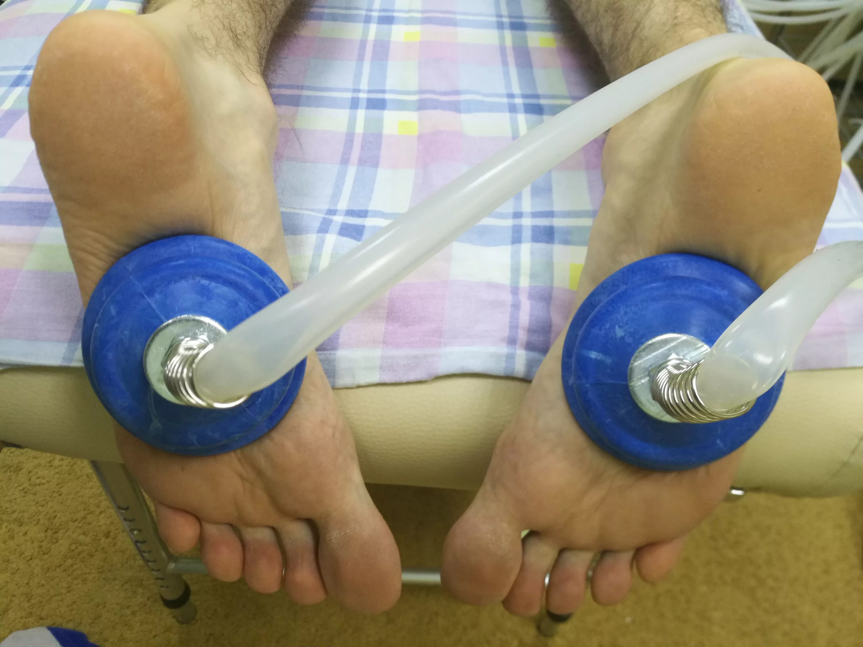 вакуумный массаж бедер. ставят ли банки на ноги. вакуумный баночный массаж при остеохондрозе. вакуумно баночный массаж. вакуумно баночный массаж аппаратный.