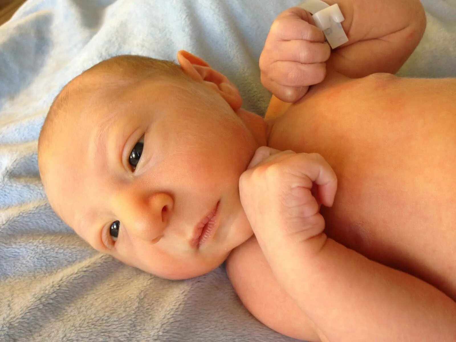 Развитие родничка. Макроцефалияу новорожденных. Головка новорожденного. Врожденные пороки развития новорожденных.