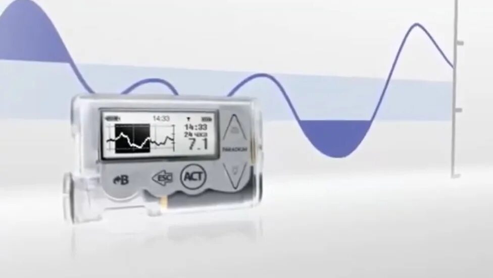 Непрерывный мониторинг Глюкозы Медтроник. Система непрерывного мониторинга Медтроник. Системы непрерывного мониторирования Глюкозы (НМГ). Система непрерывного мониторирования Глюкозы позволяет оценить.