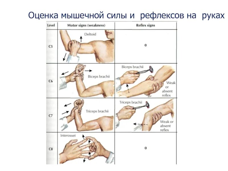 Патологические сухожильные рефлексы. Сухожильные рефлексы неврология. Глубокие сухожильные рефлексы неврология. Сухожильные рефлексы верхней конечности.