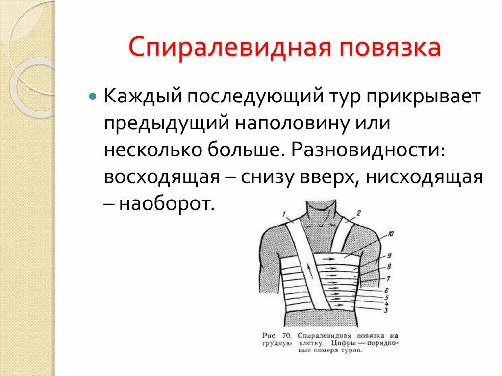 Повязка на грудную клетку алгоритм. Спиралевидная повязка на грудную клетку. Спиральная повязка на грудь. Наложение спиральной повязки на грудь. Бинтовая повязка на грудную клетку.