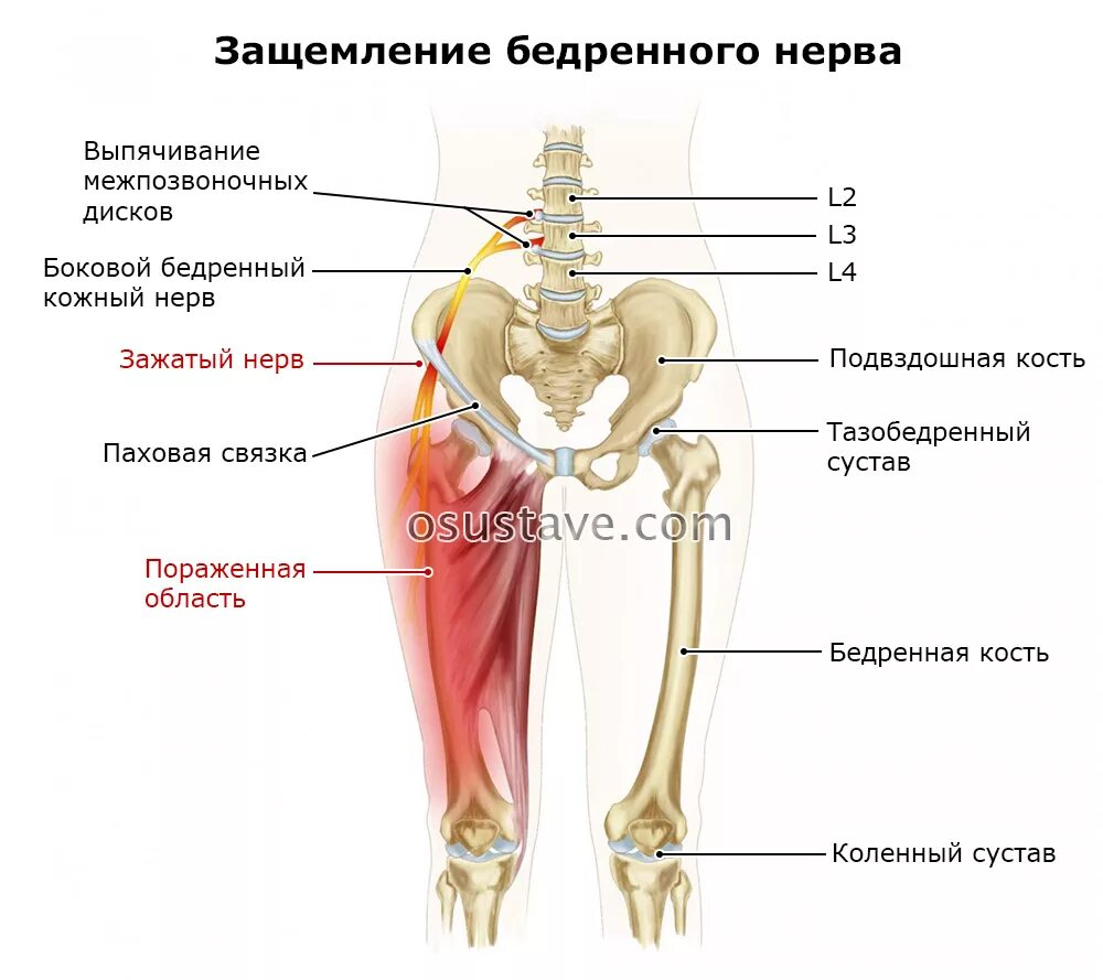 Боль от бедра до стопы. Передние кожные ветви бедренного нерва. Нерв тазобедренного сустава симптомы. Тазобедренный сустав седалищный нерв. Нерв запирательный тазобедренного сустава.