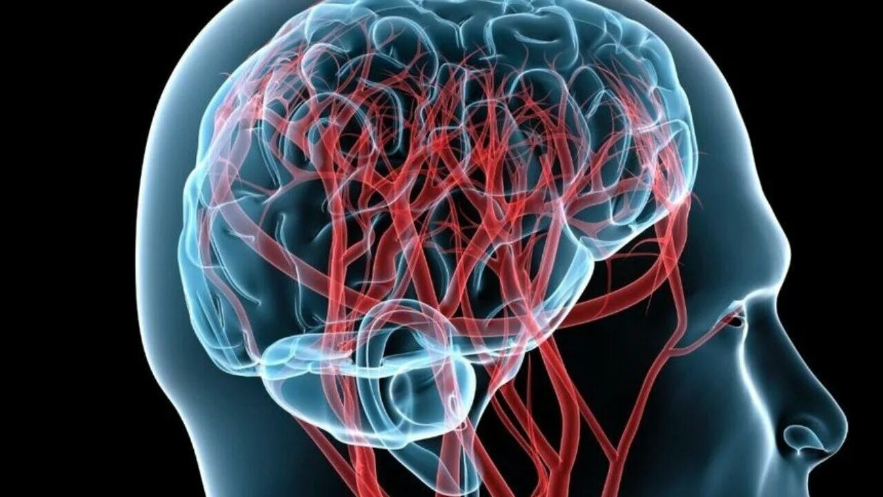 Сосудистые поражения мозга. Кровообращение мозга. Кровоток головного мозга. Сосудистая система.