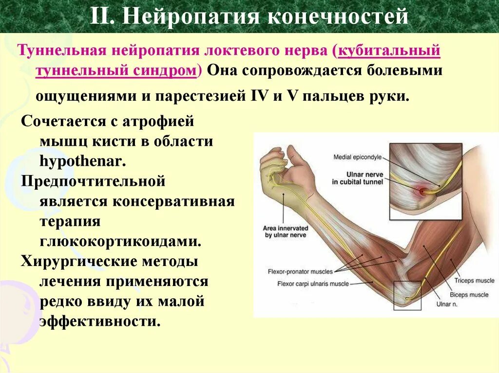 Полинейропатия причина болезни. Нейропатия локтевого нерва. Нейропатия локтевого нерва синдром. Полинейропатия лучевого нерва. Синдром поражения локтевого нерва.