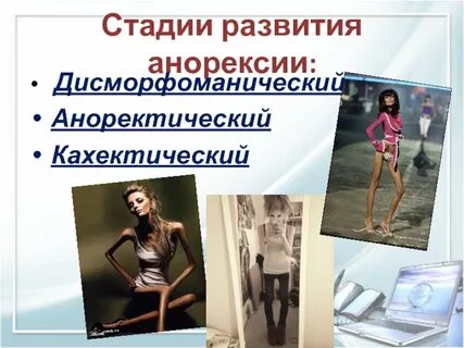 Какой вес считается анорексией