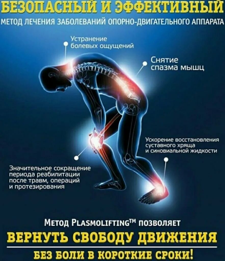 Плазма терапия коленного сустава. Плазмолифтинг суставов реклама. Лечению суставов плазмолифтингом. Prp терапия коленного сустава. Плазмотерапия сустав prp.