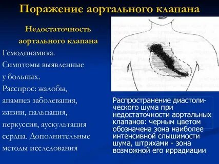 Шумы при аускультации