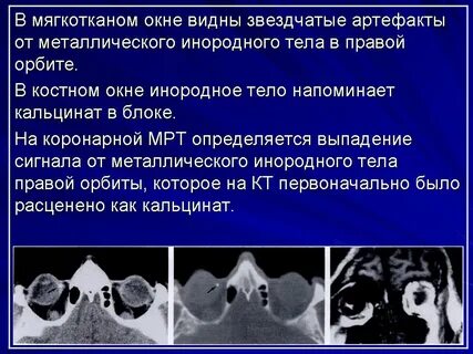 Видимой патологии