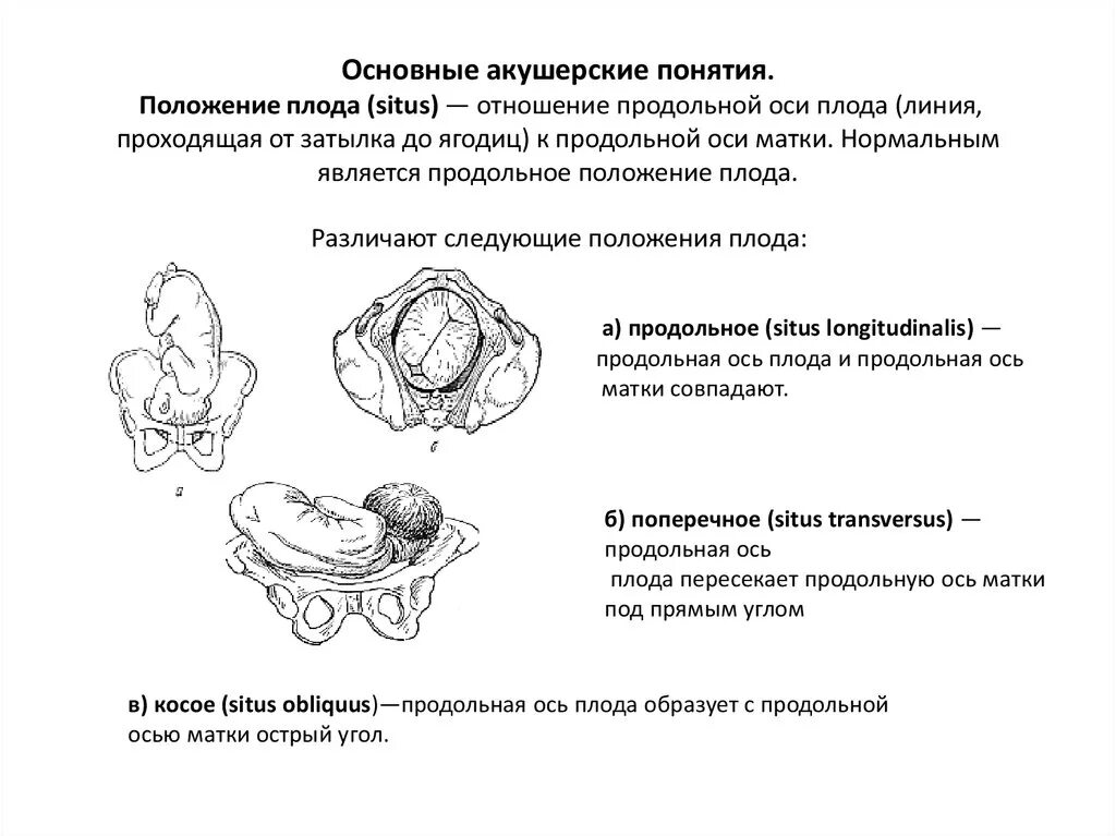 Положение плода акушерское