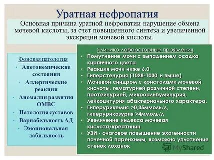 Дисметаболическая нефропатия у детей код по мкб