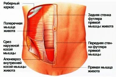 Сильно болят мышцы живота. Сильно болят мышцы живота