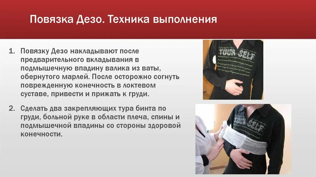 Дезо алгоритм. Накладывание повязки Дезо алгоритм. Технику наложения повязки Дезо.. Повязка Дезо техника выполнения. Повязка Дезо техника алгоритм.