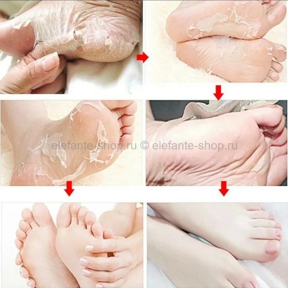 Exfoliating foot Mask маска носки для ног. Пилинг носочки Jigott clean & Moisturizing foot Pack. Маска для ног отшелушивающая Baby foot. Пилинг носочки для педикюра foot Care Mask. Отшелушивающая маска носки