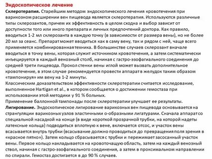 Способ введения склерозанта для остановки