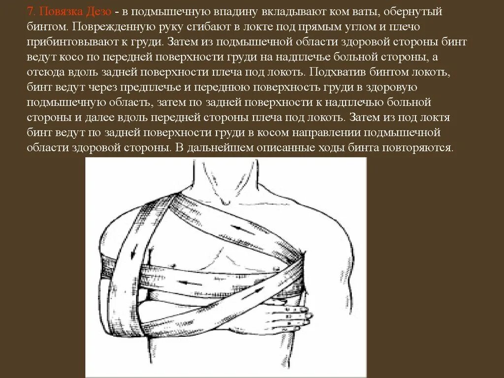 Плечевая повязка алгоритм. Схема наложения повязки Дезо. Наложение повязки Дезо алгоритм. Повязка Дезо на плечевой сустав техника. Колосовидная повязка Дезо.