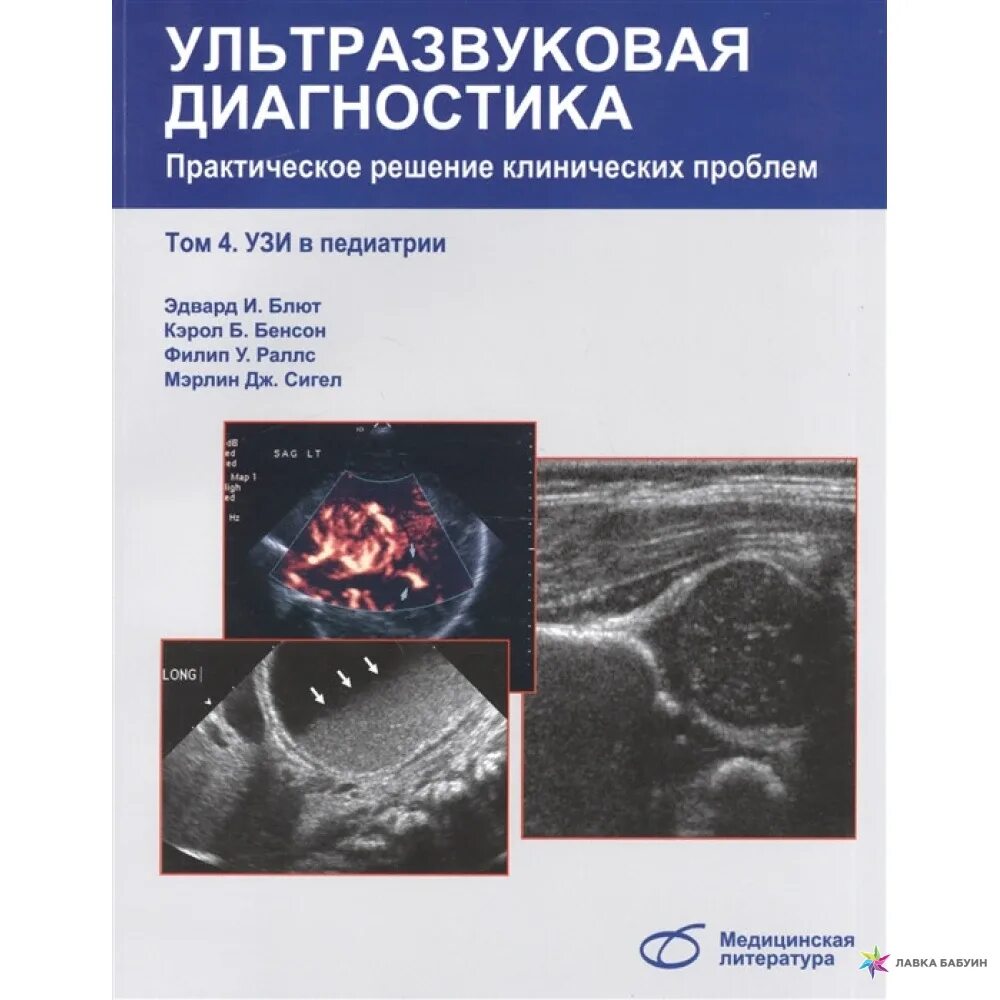 Ультразвуковая диагностика книги. УЗИ В педиатрии книги. Медицинская литература. УЗД В гинекологии.. Ультразвуковое исследование в педиатрии.