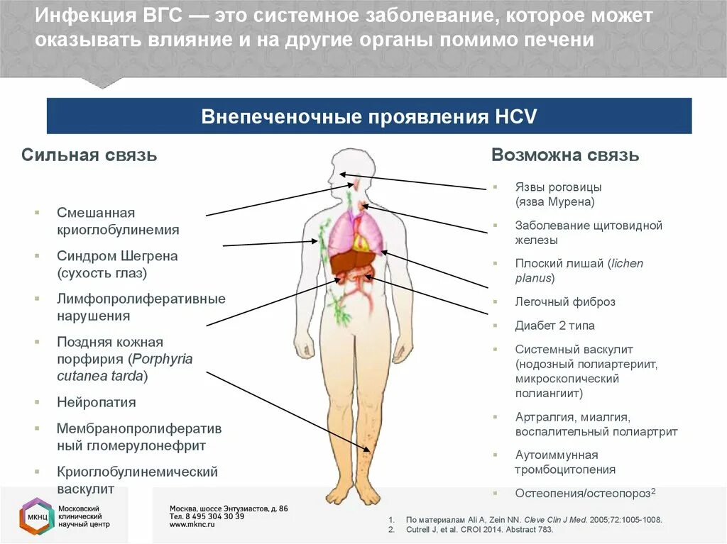 Гепатит с поражение. Внепеченочные проявления хронических вирусных гепатитов. Внепеченочные проявления гепатита с. Гепатита локализация в организме. Внепеченочные проявления HCV-инфекции.