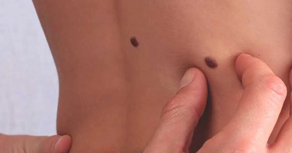 Remove tags