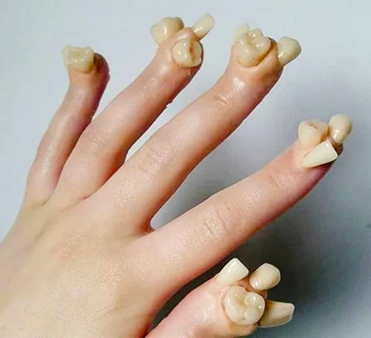 Onychophagia - Nail Biting