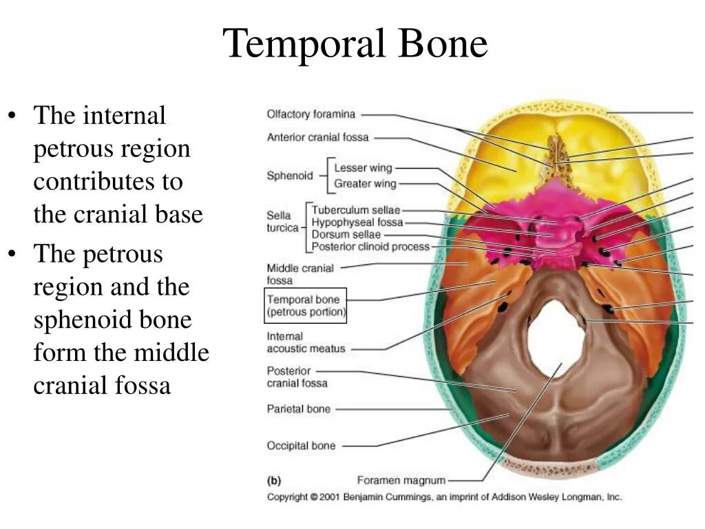 Темпорал бонез. Petrous portion of temporal Bone. Petrous Part of the temporal Bone. Foramina of the temporal Bone. The bones form