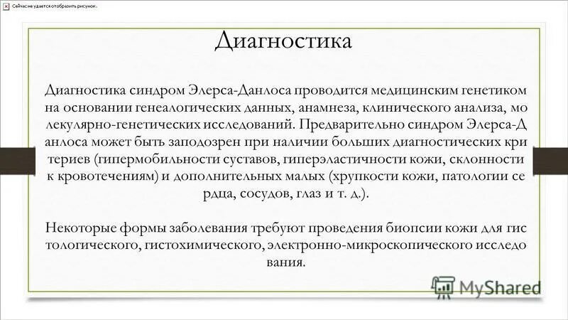 Люди с синдромом элерса-данлоса. Синдром элерса-данлоса сосудистый тип. Синдром элиса. Синдром элиса. Синдром элерса данло клинические проявления.