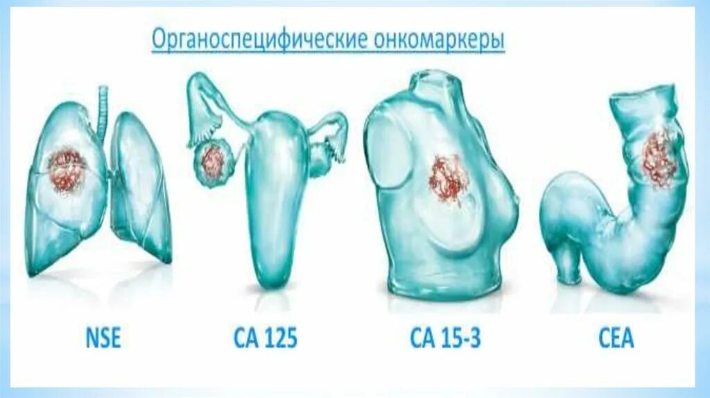 Онкомаркеры яичка. Онкомаркеры. Классификация онкомаркеров. Онкомаркеры органов. Онкомаркеры картинка.