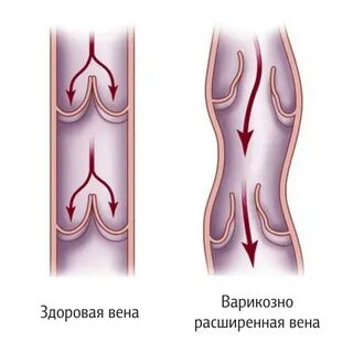 Венозная эстетическая