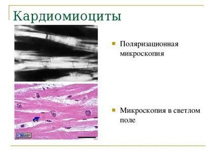 Поляризационная микроскопия