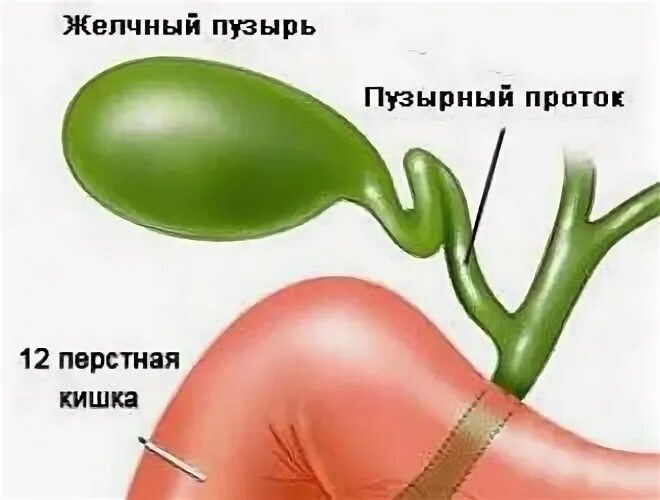 Изгиб шейки желчного. Желчный пузырь s-образный формы. Перегиб желчного пузыря. Загиб желчного пузыря.