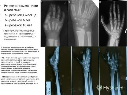 Определить кисть