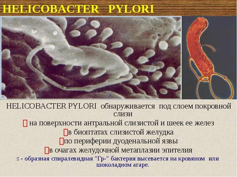 Биоптат слизистой желудка. Биопсия хеликобактер пилори. Хеликобактер пилори в слизистой. Хеликобактер пилори в желудке.