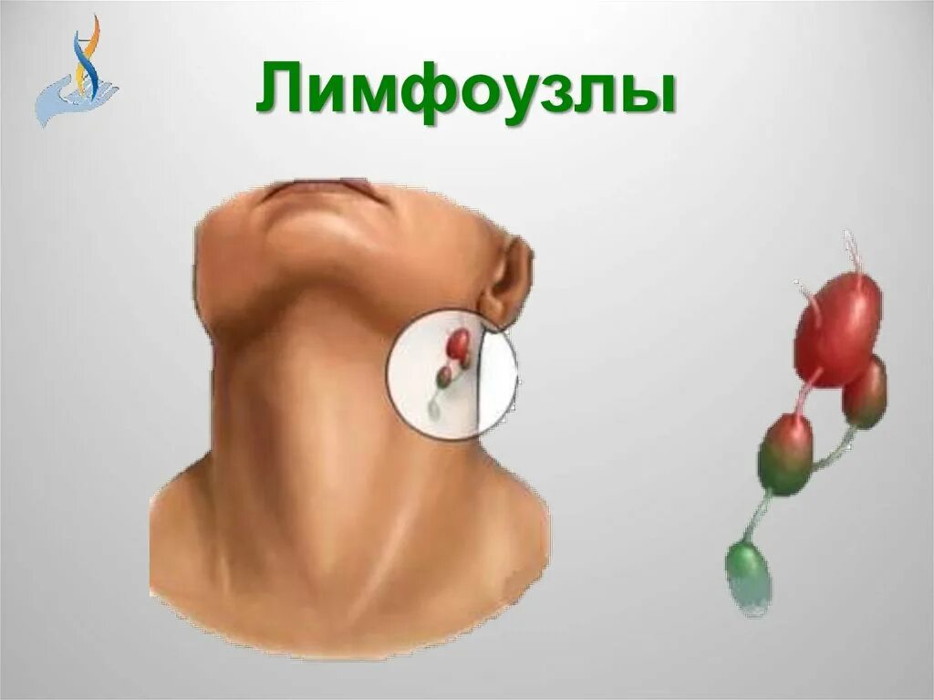Воспаление лимфатических узлов. Подподбородочный лимфоузел. Увеличенный узел. Увеличенный узел. Причины воспаления лимфатических узлов.
