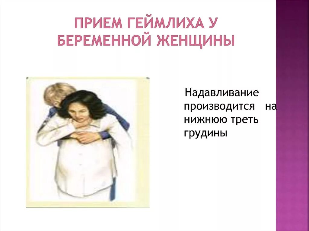 Прием геймлиха у беременных. Прием геймлиха беременным. прием хеймлиха у беременных. прием геймдиза беременны. прием геймлиха для беременных женщин.