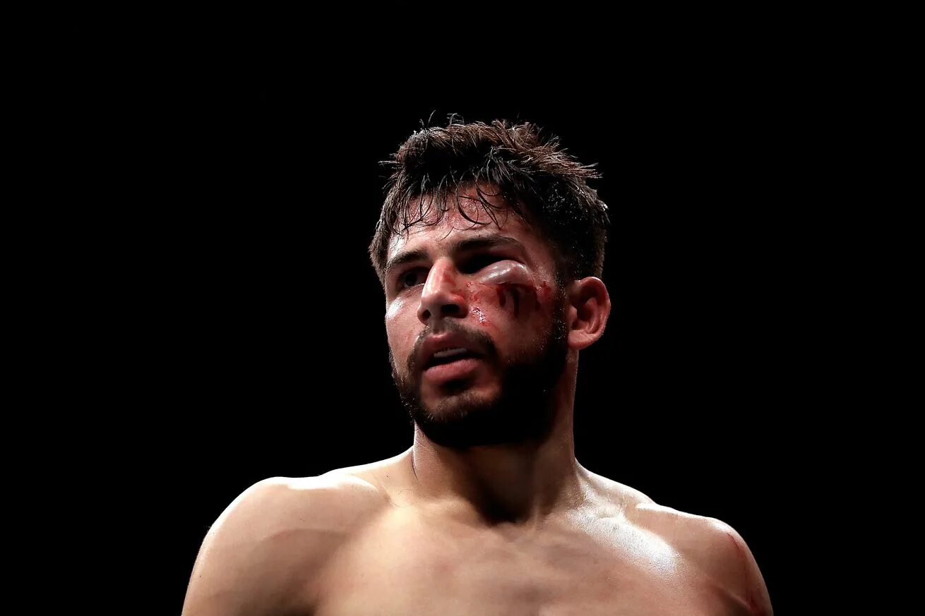 Яир Родригес. Yair Rodriguez UFC. Волоконовский Яир Родригес.