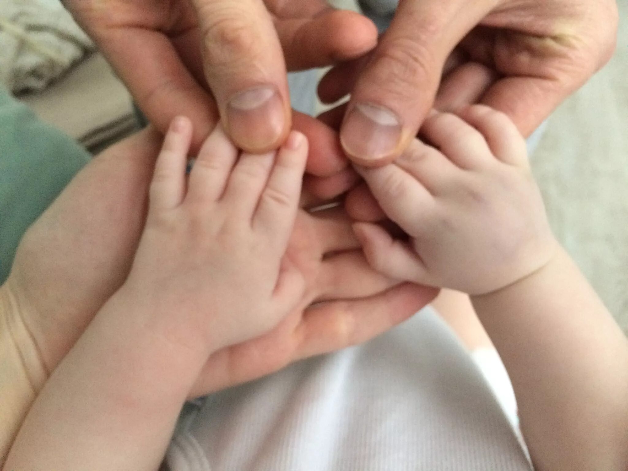 Пальчики новорожденного. У ребенка опухла кисть руки.