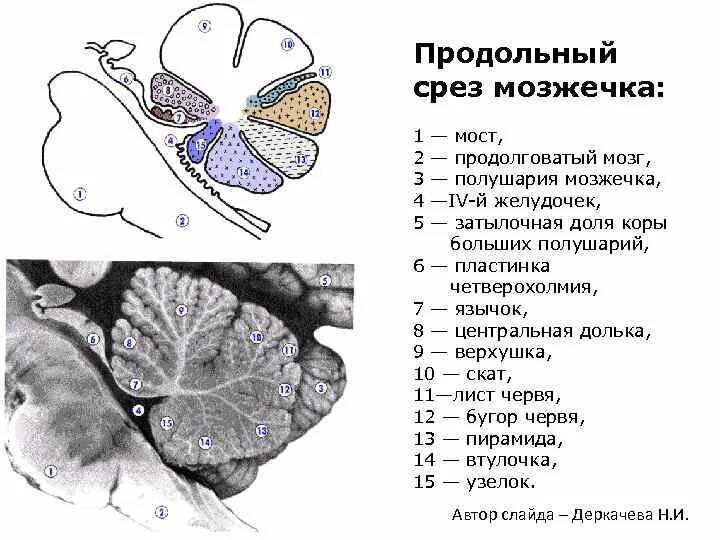 Миндалина мозжечка латынь. Строение мозжечка анатомия. дольки мозжечка анатомия. поверхности мозжечка анатомия. мозжечок поперечный разрез схема.