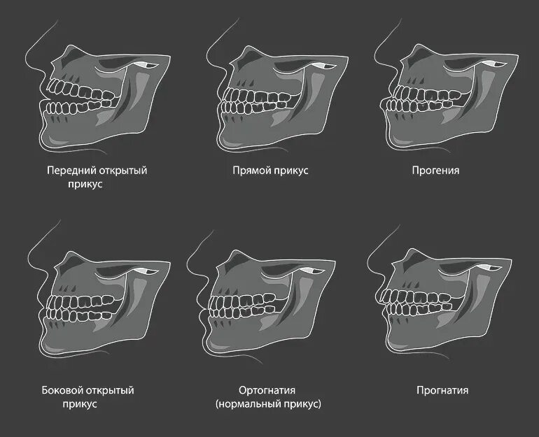 Открывая рот в мою сторону. Правильное расположение челюсти сбоку. Идеальный прикус зубов сбоку. Форма нижней челюсти сбоку. Правильное положение зубов сбоку.