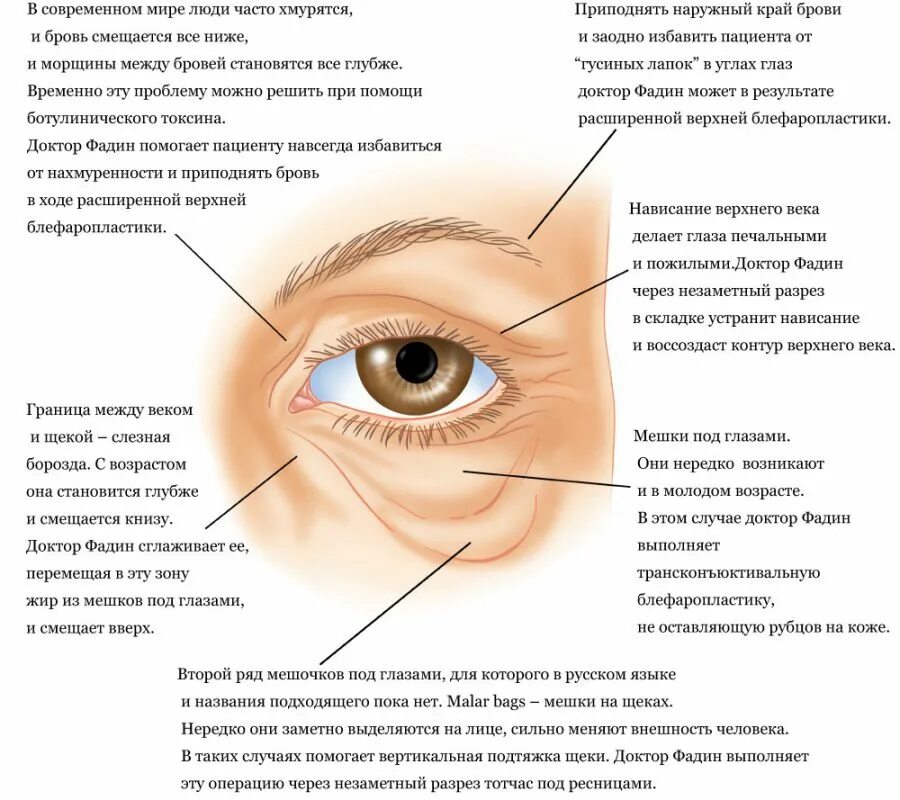 Опухла снизу глаза. Мешки под глазами сбоку причины. Периорбитальная зона (верхнее и нижнее веко). Строение Нижнего века глаза.