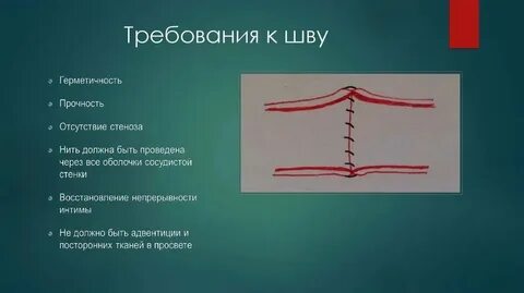 4 прямых шва