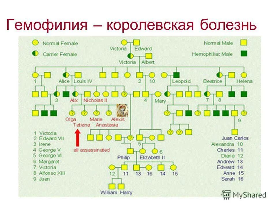 Гемофилия Королевская болезнь. Гемофилия Царская болезнь. Родословная Царская гемофилия. Гемофилия Царская болезнь причины. Гемофилия виктории