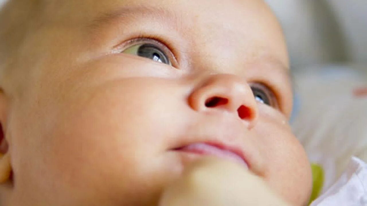 Почему у новорожденного глазки. Иктеричность склер у новорожденных. Глаза новорожденного. Желтуха у новорожденных глаза. Глаза ребенка при желтухе новорожденного.