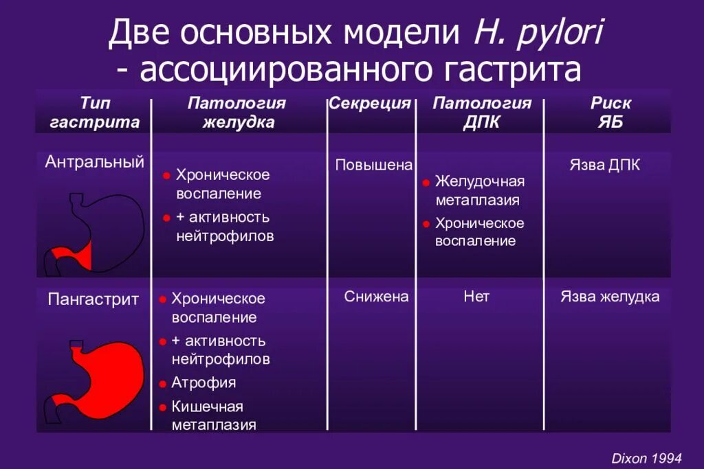 Локализация язвы 12 перстной кишки. Таблица язвенная болезнь желудка и двенадцатиперстной кишки. Факторы язвенной болезни желудка и двенадцатиперстной кишки. Причины развития язвенной болезни двенадцатиперстной кишки. Гастрит 2 стадии