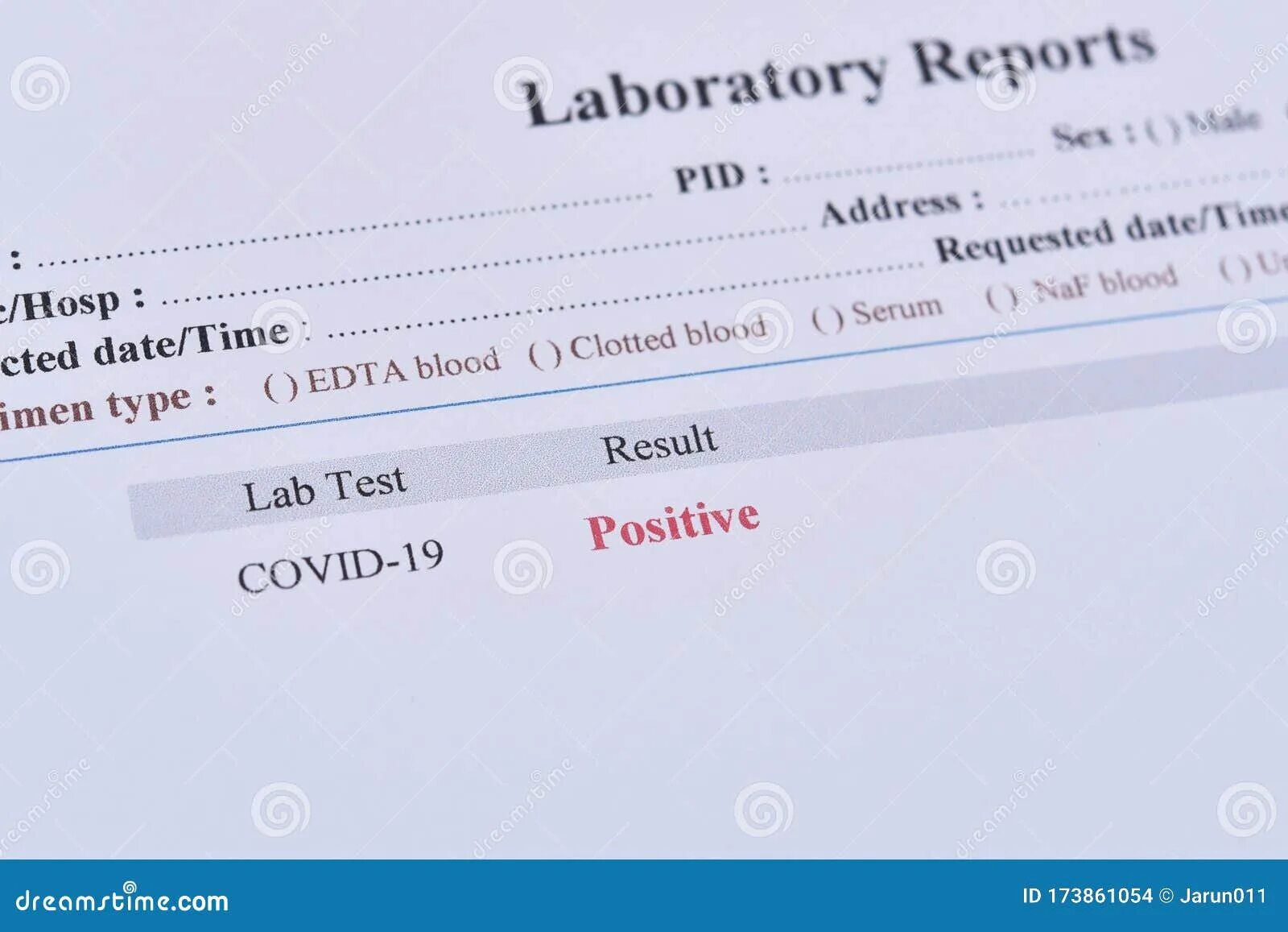 Сколько ковид положительный. Covid 19 positive Test. Covid Test положительный. Положительный тест на Covid. Тест на ковид positive это что.