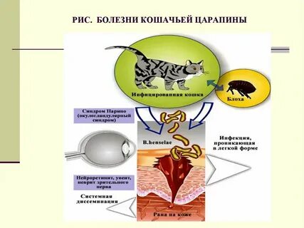Симптом кошачьей царапины