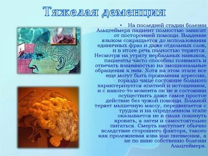 Болезнь альцгеймера последняя